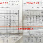 経過報告② 投薬開始2週間後の聴力検査結果や症状のまとめ／突発性難聴再発記録