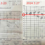 経過報告③総合病院で検査！なぜか良くなっている聴力検査…突発性難聴再発記録