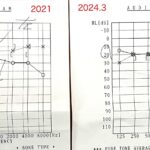 2年ぶり通院！耳鳴り難聴悪化＆めまい有で耳鼻科受診・聴力検査結果など