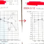 経過報告①難聴悪化通院から投薬開始1週間後の聴力検査結果や症状のまとめ／難聴再発記録